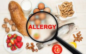 Visual of food allergy symptoms like hives, swelling, and digestive issues, representing the Food Allergen Awareness Online course.