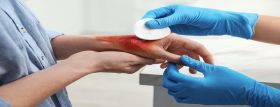 Tissue viability - assessment and treatment of wound course 