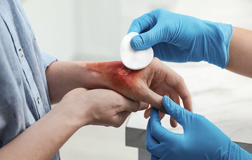 Tissue Viability - Assessment and Treatment of Wound Course